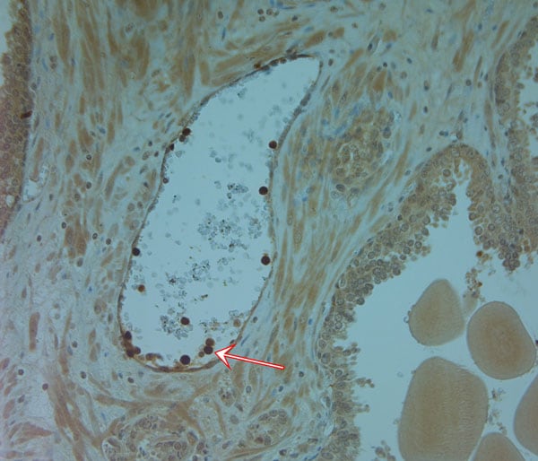 Cathelicidin Antibody in Immunohistochemistry (Paraffin) (IHC (P))