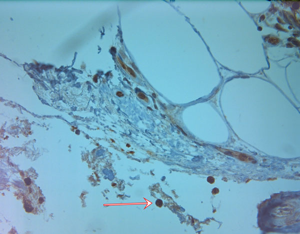 Cathelicidin Antibody in Immunohistochemistry (Paraffin) (IHC (P))