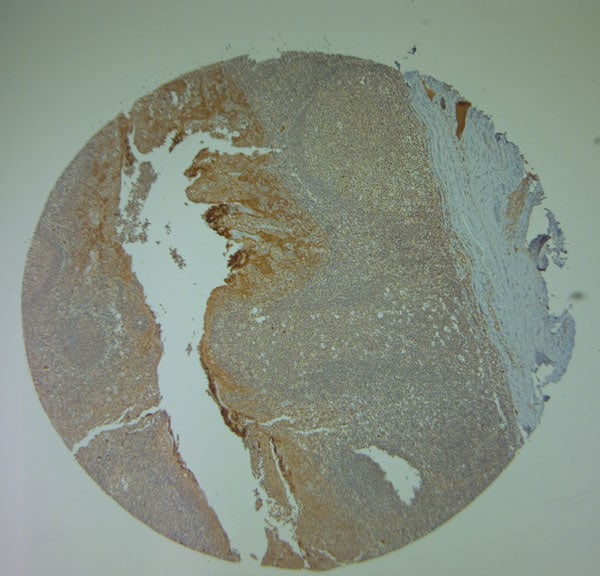 Cathelicidin Antibody in Immunohistochemistry (Paraffin) (IHC (P))