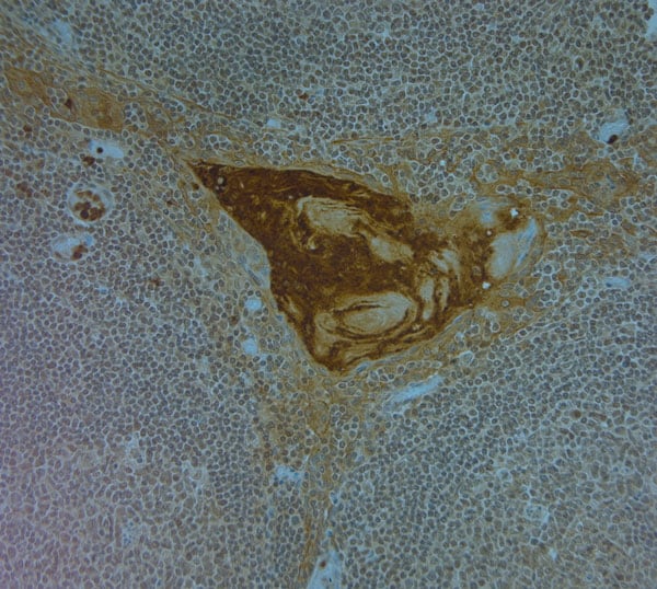 Cathelicidin Antibody in Immunohistochemistry (Paraffin) (IHC (P))