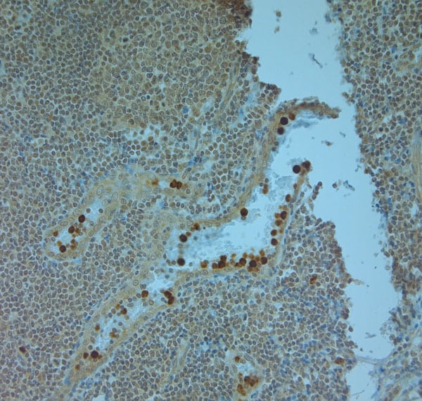 Cathelicidin Antibody in Immunohistochemistry (Paraffin) (IHC (P))