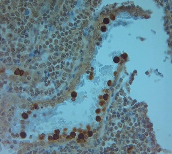 Cathelicidin Antibody in Immunohistochemistry (Paraffin) (IHC (P))