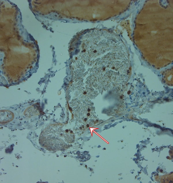 Cathelicidin Antibody in Immunohistochemistry (Paraffin) (IHC (P))