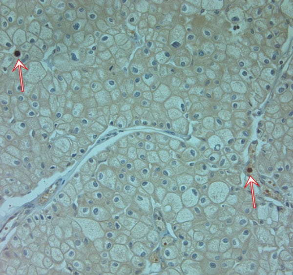 Cathelicidin Antibody in Immunohistochemistry (Paraffin) (IHC (P))