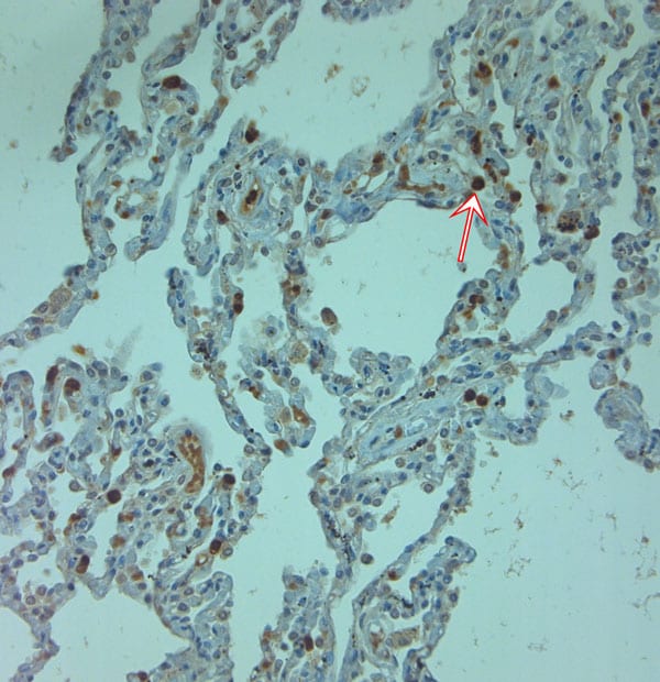 Cathelicidin Antibody in Immunohistochemistry (Paraffin) (IHC (P))