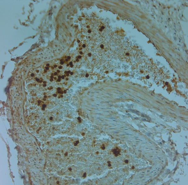 Cathelicidin Antibody in Immunohistochemistry (Paraffin) (IHC (P))