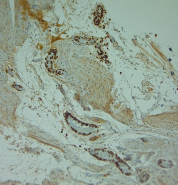 Cathelicidin Antibody in Immunohistochemistry (Paraffin) (IHC (P))