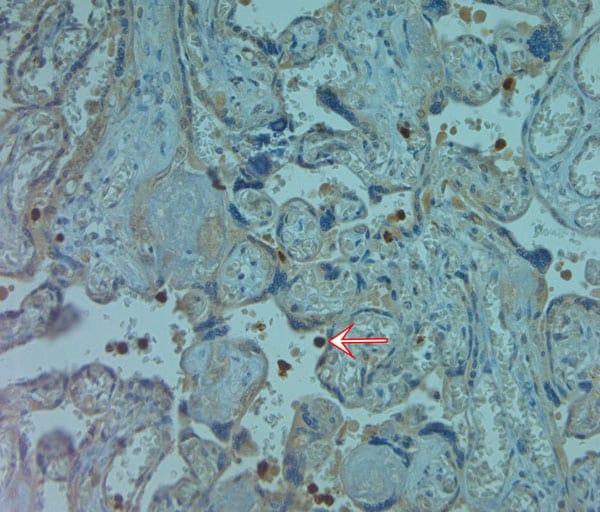 Cathelicidin Antibody in Immunohistochemistry (Paraffin) (IHC (P))