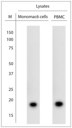 Cathelicidin Antibody in Western Blot (WB)