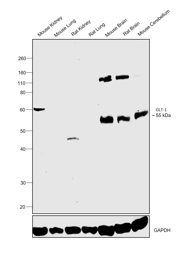 GLT-1 Antibody in Western Blot (WB)