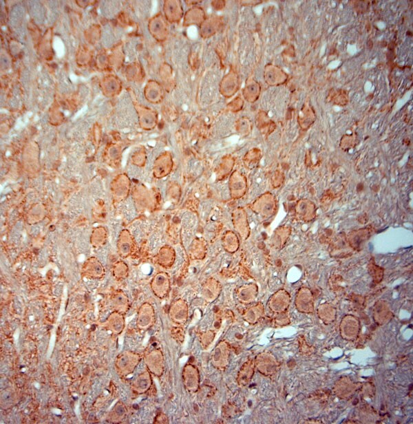 Synaptophysin Antibody in Immunohistochemistry (Paraffin) (IHC (P))