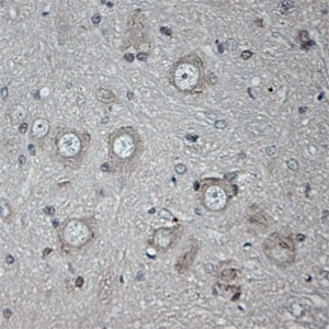 ULK1 Antibody in Immunohistochemistry (Paraffin) (IHC (P))