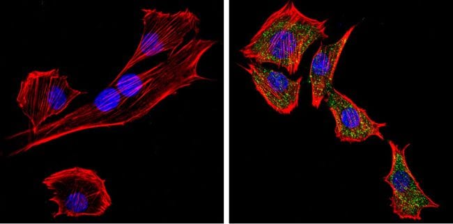 PCSK2 Antibody in Immunocytochemistry (ICC/IF)