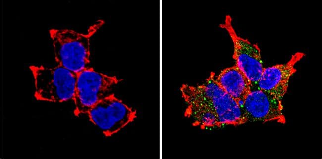 PCSK2 Antibody in Immunocytochemistry (ICC/IF)