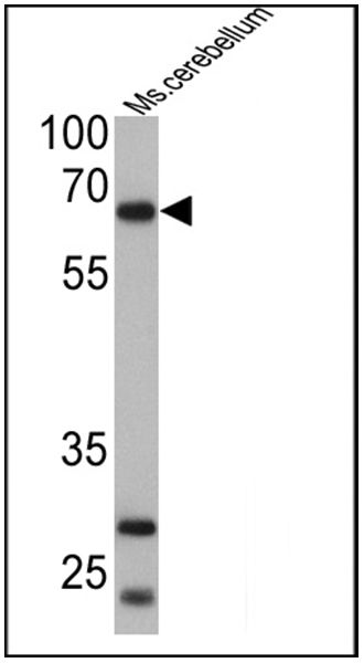 PCSK2 Antibody in Western Blot (WB)