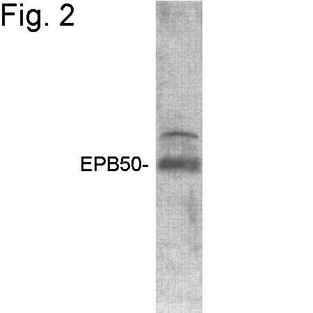 EBP50 Antibody in Western Blot (WB)