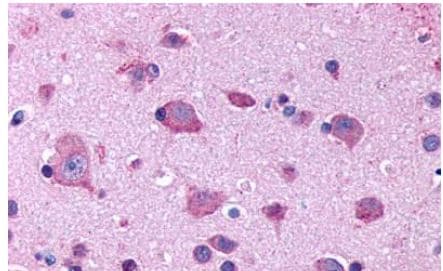 HTR2B Antibody in Immunohistochemistry (Paraffin) (IHC (P))