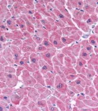 ARC Antibody in Immunohistochemistry (Paraffin) (IHC (P))