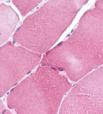 ARC Antibody in Immunohistochemistry (Paraffin) (IHC (P))