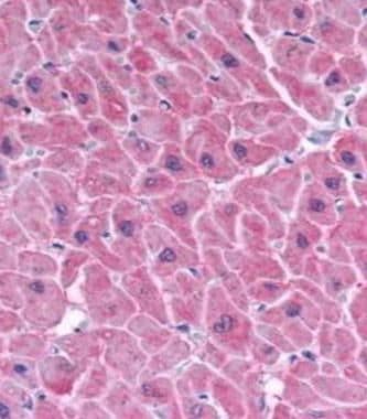 ARC Antibody in Immunohistochemistry (IHC)