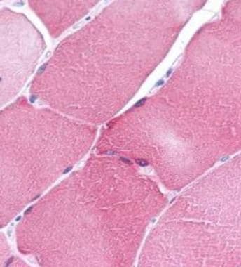 ARC Antibody in Immunohistochemistry (IHC)