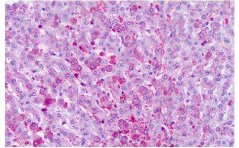 FZD6 Antibody in Immunohistochemistry (Paraffin) (IHC (P))