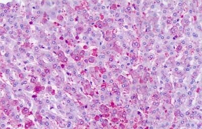 FZD6 Antibody in Immunohistochemistry (Paraffin) (IHC (P))