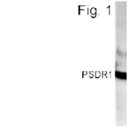 RDH11 Antibody in Western Blot (WB)