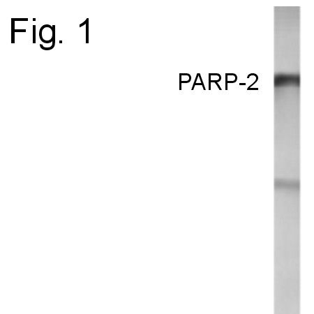 PARP2 Antibody in Western Blot (WB)