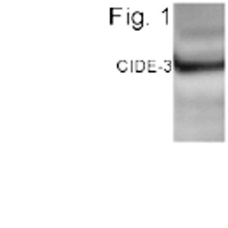 CIDEC Antibody in Western Blot (WB)