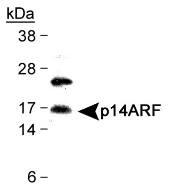 p14ARF Antibody in Western Blot (WB)