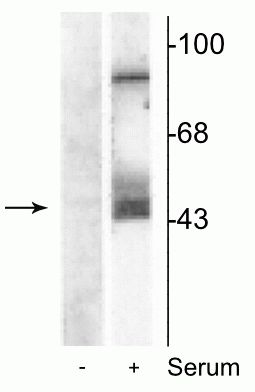 Phospho-MEK1/MEK2 (Ser217, Ser221) Antibody in Western Blot (WB)