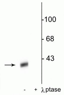 Phospho-DARPP-32 (Thr34) Antibody in Western Blot (WB)