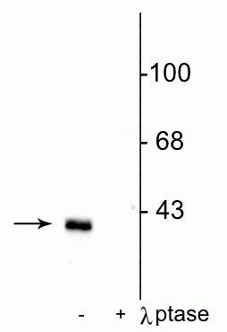 Phospho-DARPP-32 (Thr75) Antibody in Western Blot (WB)
