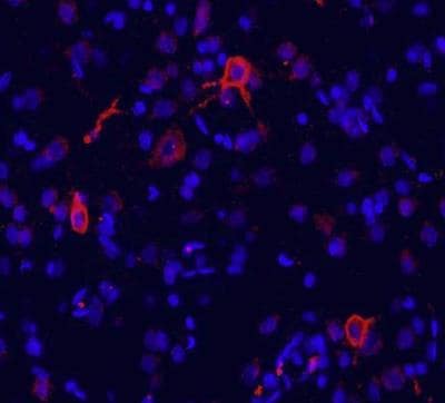 mGluR1 Antibody in Immunohistochemistry (Frozen) (IHC (F))