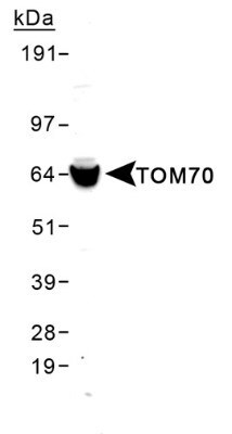 TOM70 Antibody in Western Blot (WB)