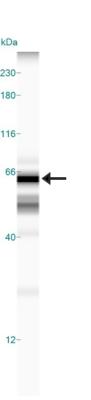 TOM70 Antibody in Western Blot (WB)