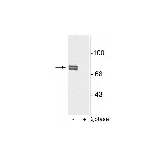 Phospho-ALOX5 (Ser523) Antibody in Western Blot (WB)