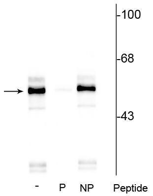 Phospho-TPH1 (Ser260) Antibody in Western Blot (WB)