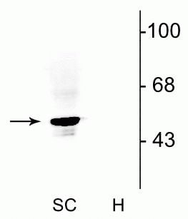 GLRA1 Antibody in Western Blot (WB)