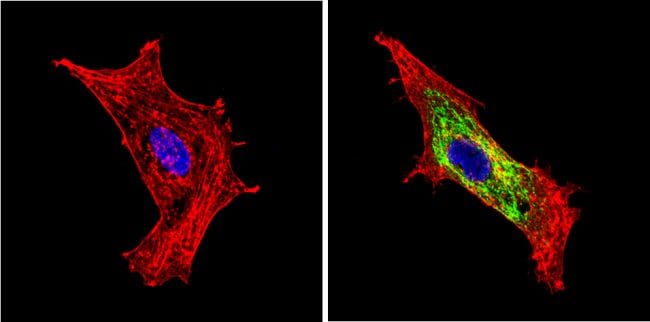 BACE1 Antibody in Immunocytochemistry (ICC/IF)