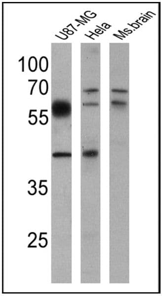 BACE1 Antibody in Western Blot (WB)