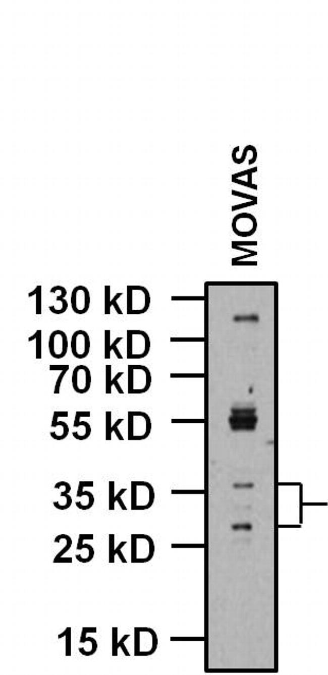 KCNMB1 Antibody in Western Blot (WB)