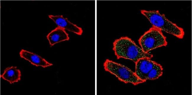 VDAC Antibody in Immunocytochemistry (ICC/IF)