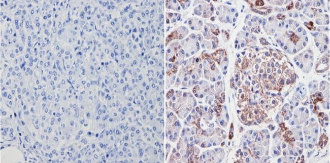 VDAC Antibody in Immunohistochemistry (Paraffin) (IHC (P))