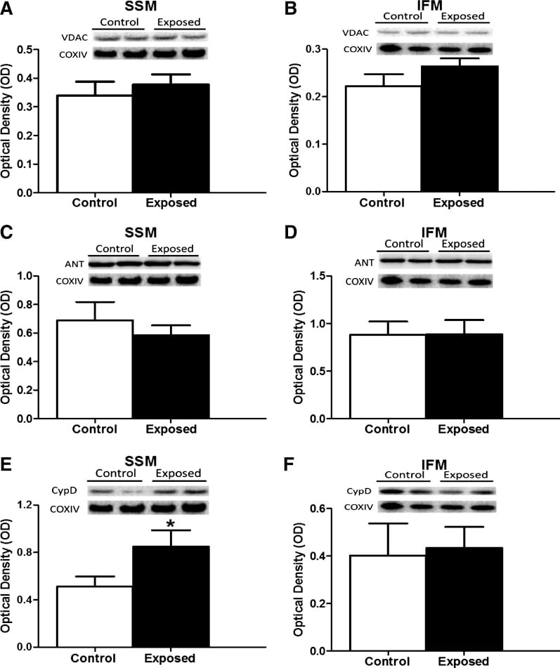 Cyclophilin 40 Antibody in Western Blot (WB)