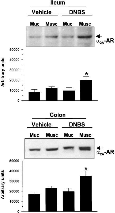 alpha-2a Adrenergic Receptor Antibody in Western Blot (WB)