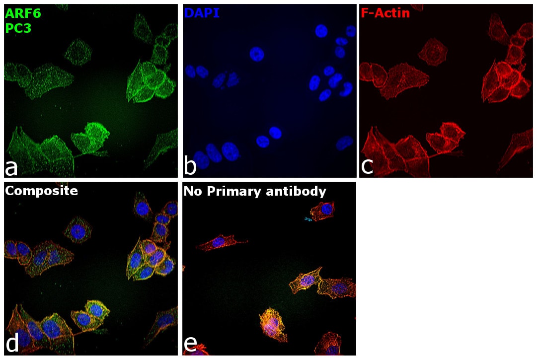 ARF6 Antibody in Immunocytochemistry (ICC/IF)