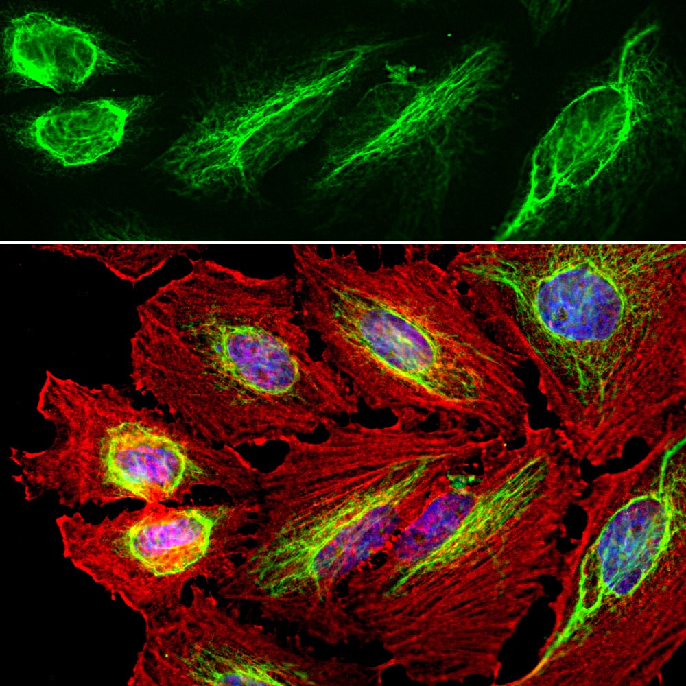 Vimentin Antibody (PA1-10003)