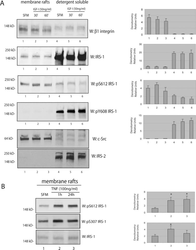 IRS1 Antibody in Western Blot (WB)